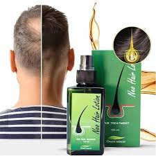 Green Wealth Neo Hair Lotion In Pakistan | 03009786886