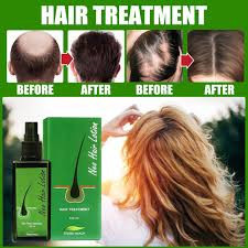 Green Wealth Neo Hair Lotion In Multan | 03009786886