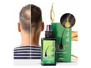 Green Wealth Neo Hair Lotion In Sargodha | 03009786886